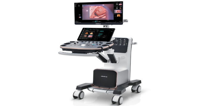 Revolutionizing Baby Care with the Nuewa I9 Ultrasound System Revolutionizing Baby Care with the Nuewa I9 Ultrasound System